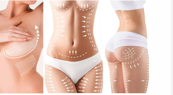 The Mommy makeover Miami can help improve body contours that cannot be achieved with diet or exercise alone